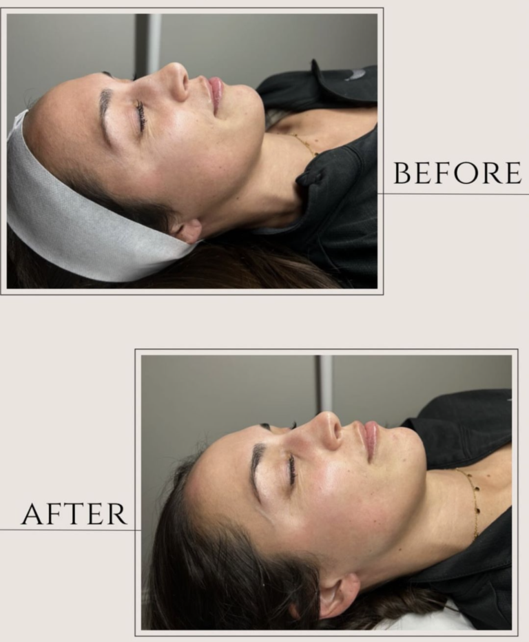 The GLO2 Facial Near Me