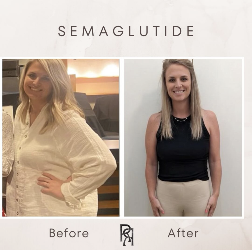 medical weight loss before & after columbus ohio