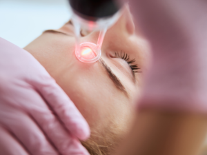CO2 Laser Resurfacing Tips and Guide: What to Know Before & After Treatment